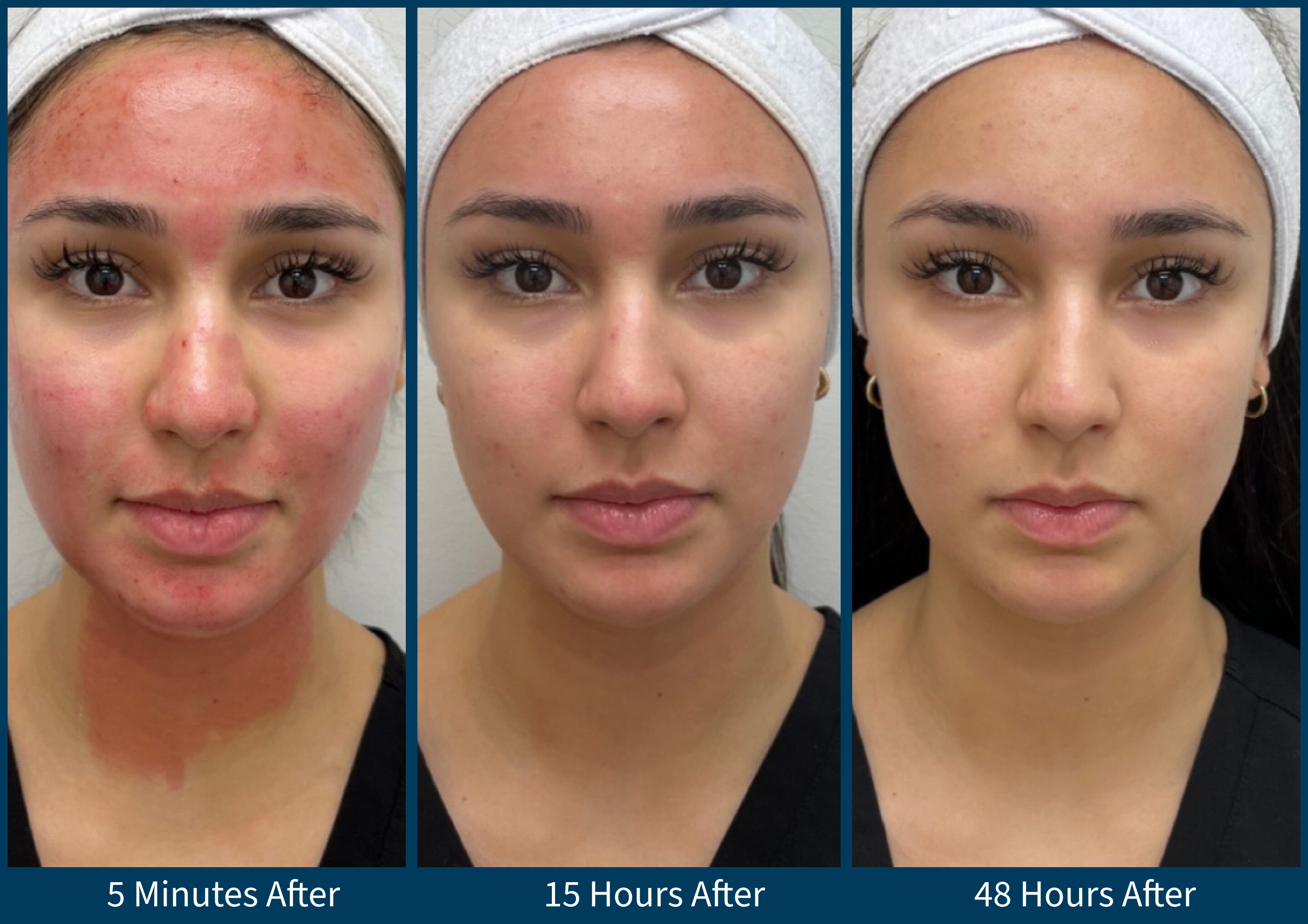 SP_Downtime_Before_After_Female24_SouthOkanagan_20230109